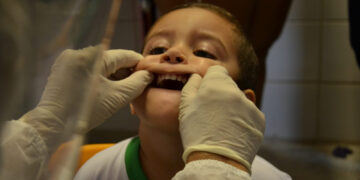 Prefeitura de Campina Grande já adota medidas de prevenção monitoramento a possíveis casos de hepatite aguda pediátrica