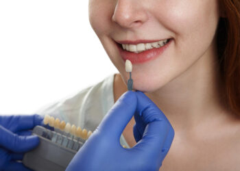 Tratamentos avançados, facetas de porcelana e lentes de contato dental transformam sorrisos