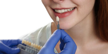 Tratamentos avançados, facetas de porcelana e lentes de contato dental transformam sorrisos