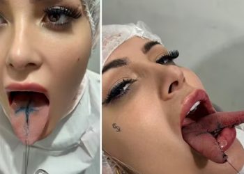 Imagens fortes: Andressa Urach faz procedimento de ‘língua de cobra’ em busca de ‘maior prazer’; vídeo