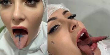 Imagens fortes: Andressa Urach faz procedimento de ‘língua de cobra’ em busca de ‘maior prazer’; vídeo