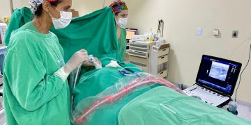 Hospital compra novo aparelho de ultrassom com valor arrecadado na 3ª Corrida contra o Câncer do Laureano